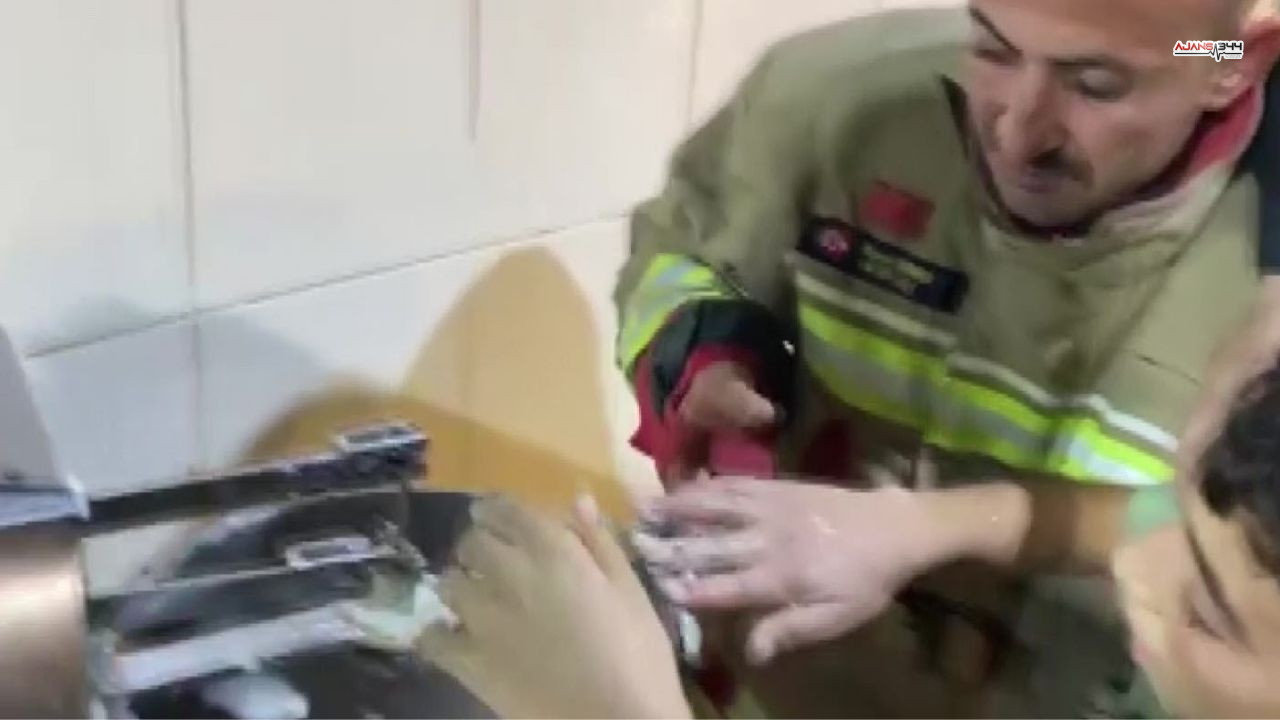 Elini Hamur Karsıtırma Makinesine Kaptıran Çocuk Kurtarıldı Ajans344 (2)