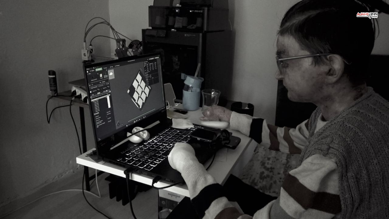 Kelebek Hastası Genç Ajans344 (3)