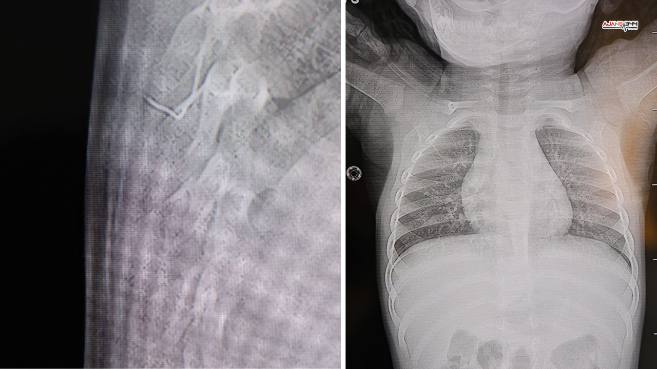 Çıkartılan Tel Ajans344 (1)