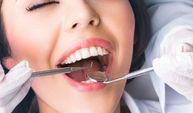 Diş taşı nedir ve neden olur? İşte diş taşlarıyla ilgili bilinmesi gerekenler