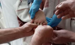 Elbistan’da Yaşlı Kadının Parmağındaki Yüzüğü İtfaiye Çıkardı