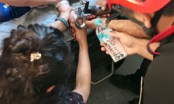Kahramanmaraş’ta Çocuğun Parmağı Musluk Aynasına Sıkıştı