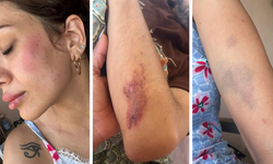 Sokak Köpeklerini Besleyen Veterinere Komşu Dayağı