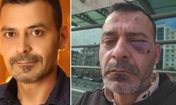 Kukla Sanatçısı Adem Ocaktan'ı Öldüresiye Darp Ettiler!