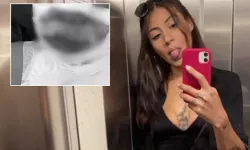 Lüks Semtte Korkunç Saldırı! Genç Kadın Alevler İçinde Kaldı