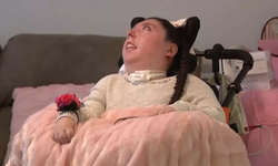 Beyinsiz Doğdu Doktorlar 5 Yıl Yaşamaz Demişti 20. Yaşını Kutluyor