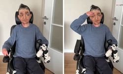 Kahramanmaraş’ta Kelebek Hastası Gençten Yardım Çağrısı