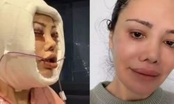 Yüz nakli olan ünlü isimden acı haber geldi!