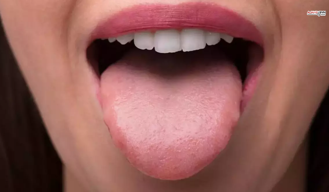 Dilinize Dikkat Edin Hastalık Belirtisi Olabilir