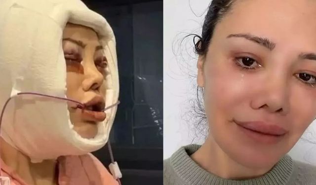 Yüz nakli olan ünlü isimden acı haber geldi!