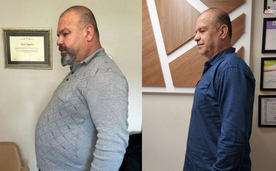 Kahramanmaraş'ta 150 Kiloyla Başladı, 52 Kilo Vererek Adeta Yeniden Doğdu